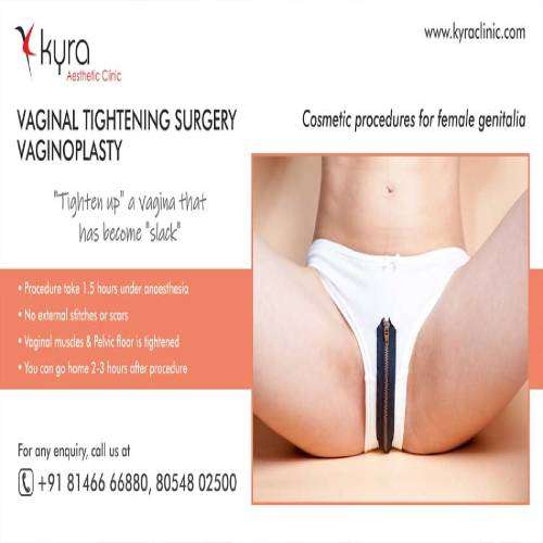 Best Vaginal Tightening in Khanna