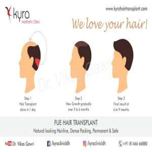 Best FUE Hair Transplant in Chandigarh
