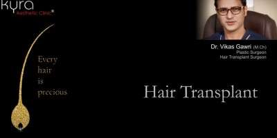 View Photo(s) of Hair Transplant
